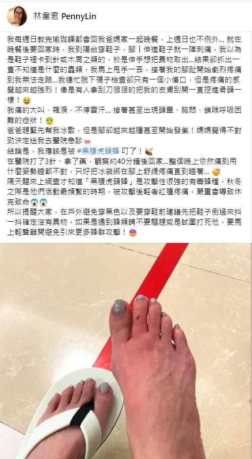 林韋君日前被躲在鞋子裡的虎頭蜂叮咬，她在臉書上敘述這驚恐的過程，也PO出腳腫如麵龜的照片。（圖／翻攝自林韋君臉書）